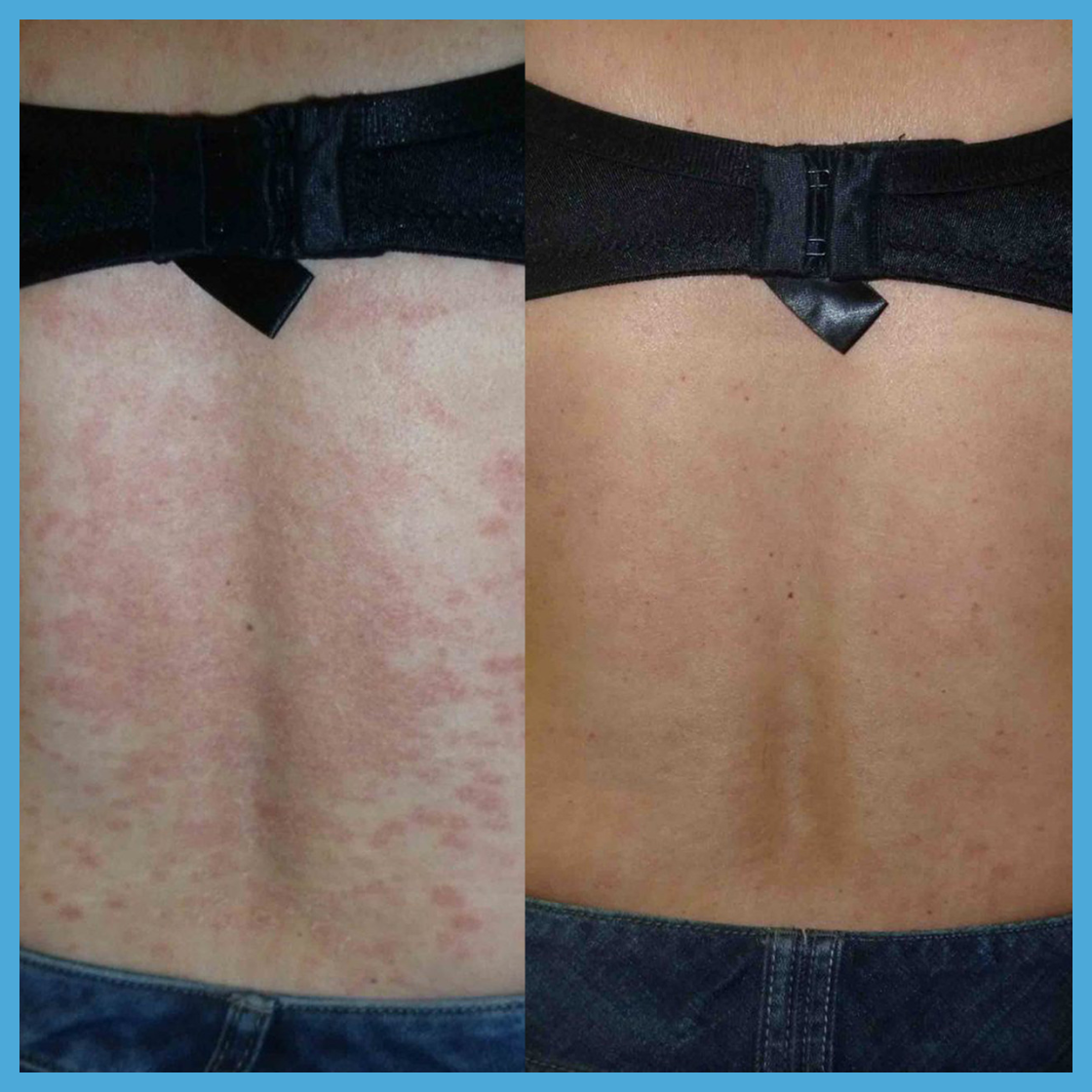 NovaraLabs™️ Relief Cream