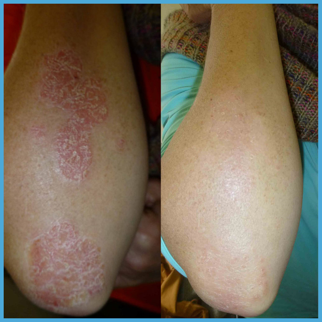 NovaraLabs™️ Relief Cream