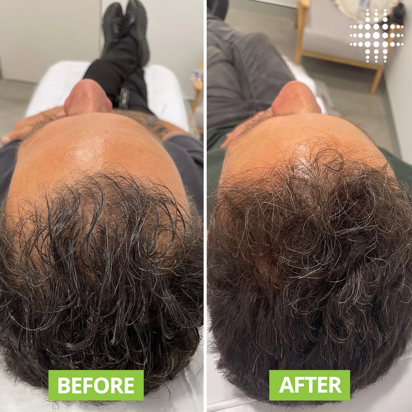 NovaraLabs™️  Hair Growth Roll