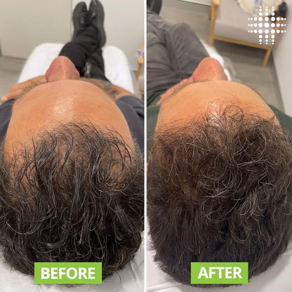 NovaraLabs™️  Hair Growth Roll